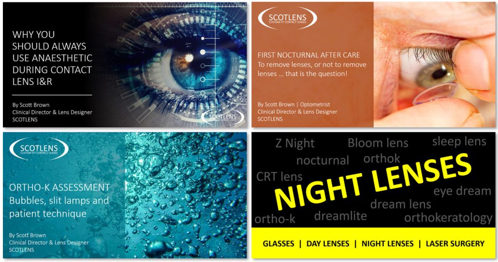 Scotlens - custom fit contact lenses - scott brown blogs
