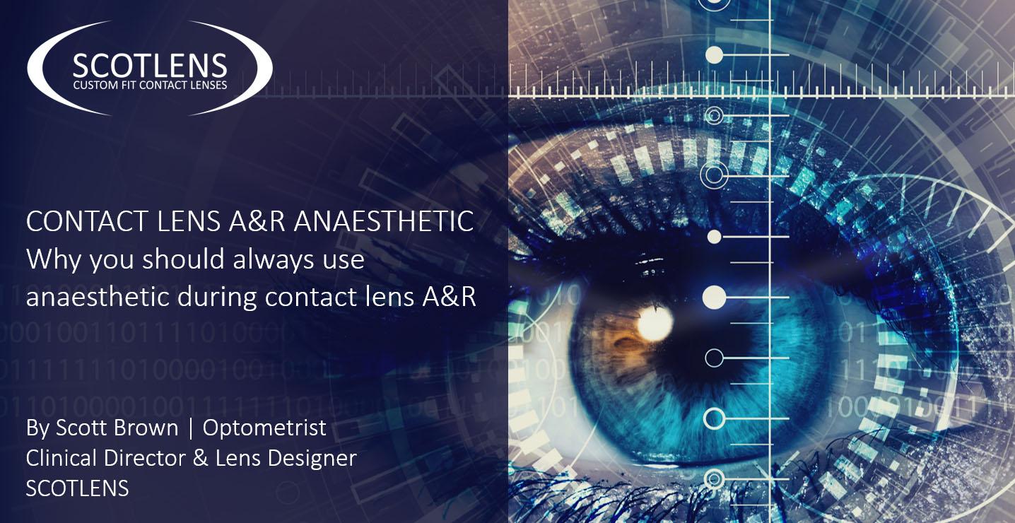 Why you should always use anaesthetic during contact lens I&R